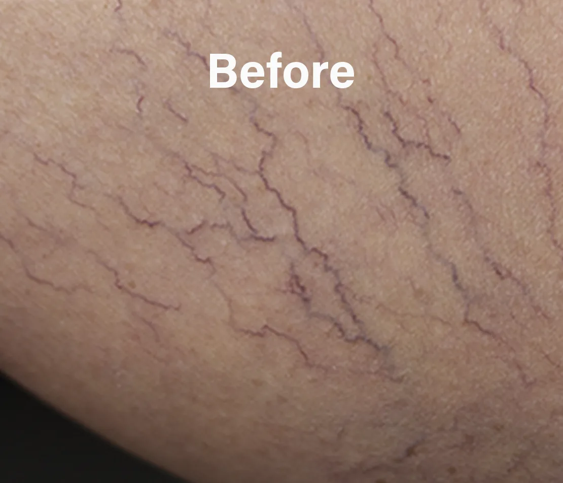 vipcenters_ny_before-after_img1