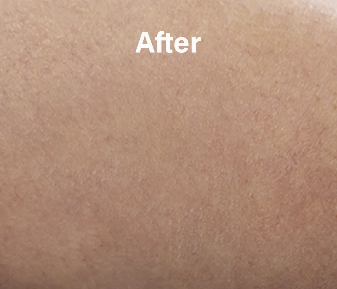 vipcenters_ny_before-after_img2